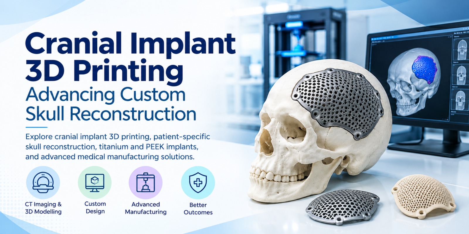 Cranial Implant 3D Printing - Atomic Additive